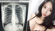 韩女模崔素美自曝X光照 反驳胸部整形传闻