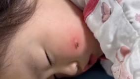 妈妈录下女儿被蚊子咬的视频，网友：怎么忍住的