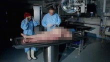 恐怖！bbc纪录片解剖108公斤肥胖女尸